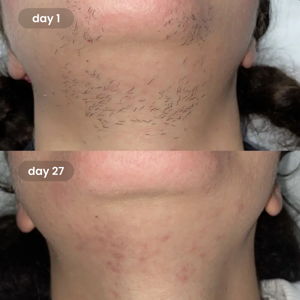 Revival™ Cyperus Rotundus Oil