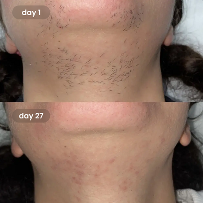 Revival™ Cyperus Rotundus Oil